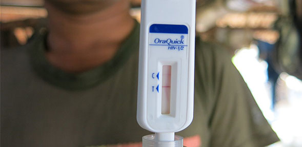 una-epidemia-de-sida-esta-diezmando-a-los-warao